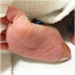 聖母病院での和痛分娩・出産レポート2016年